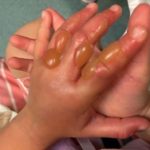 Warning as girl, 4, suffers horrific burns after touching UK's 'most dangerous' plant